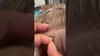 Lice removal l small business explore hair lice hairvideo liceremoval shorts [upl. by Hsirk]