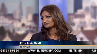 Elite Hair Graft 2 min [upl. by Marsden]