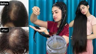 1 महीने में Flaxseeds Gel से Hair को Grow करने का तरीक़ा जो किसी ने नहीं बताया होगा  Shanu Priya [upl. by Nekial200]