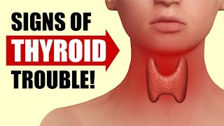 14 Signs Your Thyroid Is In Trouble [upl. by Tergram]