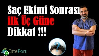 Saç Ekimi Sonrası İlk Üç Güne Dikkat amp Esteport Klinik [upl. by Judy716]