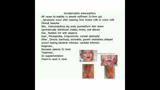 👒 Acrodermatitis enteropathica 👒 [upl. by Ephram258]