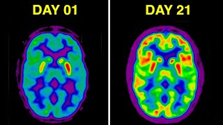 दिमाग को कमज़ोर करने वाली 5 चौकाने वाली आदतें  5 Shocking Brain Damaging Habits [upl. by Colner]