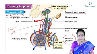 Diabetes Insipidus Hindi  Internal Medicine [upl. by Pacheco]