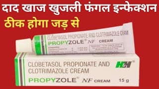 Propyzole NF Cream Uses  Clobetasol Propionate And Clotrimazole Cream  Fungul Infection दाद [upl. by Agripina]