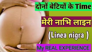 Nabhi line Se Kaise Pata Kare Ladka Hai Ya Ladki ।Baby Boy Or Girl Prediction In Pregnancy । [upl. by Ajet]