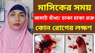 মাসিকের সময় জমাট বাধা রক্ত কেন আসেএর লক্ষণ চিকিৎসা ও মুক্তির উপায় কি  Blood clots in period [upl. by Nosrej]