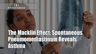 The Macklin Effect Spontaneous Pneumomediastinum Reveals Asthma [upl. by Ariella690]