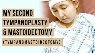 My Second Tympanoplasty and Mastoidectomy Tympanomastoidectomy [upl. by Akram100]