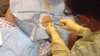 Drain That Belly Paracentesis Dr ERs Medical Monday Special [upl. by Reinald396]