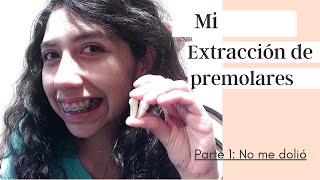 Mi extracción de primeros premolares  Parte 1 de 2 [upl. by Egiaf958]