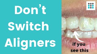 DON’T SWITCH ALIGNERS IF YOUR TEETH ARE NOT TRACKING l Dr Melissa Bailey Orthodontist [upl. by Jarrid]