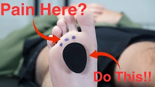 Metatarsal Pad Correct Placement [upl. by Krik]