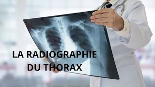 Critères dinterprétation dune radiographie thoracique radiologie [upl. by Hailahk510]