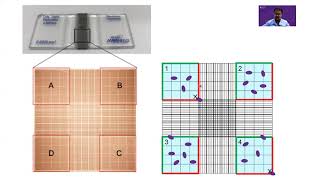 Counting cells on a hemocytometer [upl. by Coppins764]