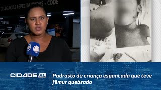 Padrasto de criança espancada que teve fêmur quebrado se entrega à polícia [upl. by Haronid110]