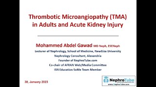 Thrombotic Microangiopathy TMA in Adults and Acute Kidney Injury  Arabic Language  Dr Gawad [upl. by Hedvah524]