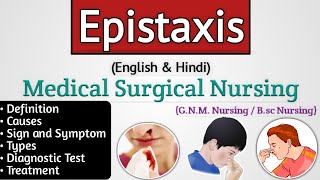 Epistaxis ent lecture  Epistaxis in hindi  Nosebleed [upl. by Albie]