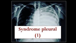 le syndrome pleural partie 1 [upl. by Eserrehs690]