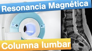 Resonancia magnética Lumbar  Cuándo y cómo se realiza [upl. by Anairb]