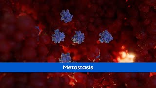 Medical Animation  Cancer Metastasis [upl. by Mansfield]