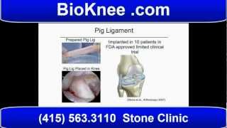 Best Knee Replacement Surgeons and Doctors [upl. by Hamon]