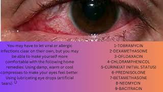 viral eye infection cure for infection how to cure eye infection tobramycin [upl. by Fulmer]