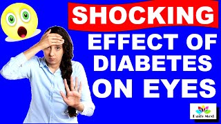 Shocking Effect Of Diabetes On Eye Cataract  Sorbitol Pathway In Diabetes  Daily MED [upl. by Ynneb]