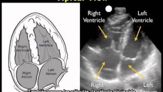 Procedimiento para realizar una ecocardiografía  Vista apical [upl. by Biddick]