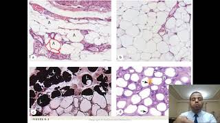 6 Adipose Tissue [upl. by Sams]