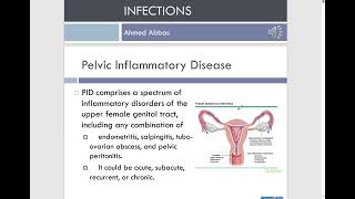 Clinical Genitourinary  PID [upl. by Godspeed]