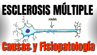 Esclerosis múltiple CAUSAS y FISIOPATOLOGÍA  P1 [upl. by Zetneuq]