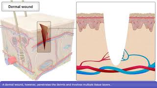 Skin Wound Healing Process [upl. by Alra571]