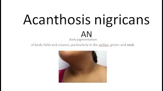 Medicine 1175 Acanthosis nigricans causes insulin resistance treatment skin dermatology dark line [upl. by Allrud]