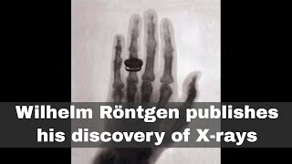 28th December 1895 Wilhelm Röntgen publishes his discovery of Xrays [upl. by Arri]