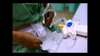 Continuous Ambulatory Peritoneal Dialysis [upl. by Ybbed786]