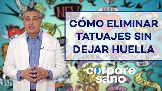 ¿Existe alguna técnica para eliminar tatuajes sin dejar huella [upl. by Dlareg]