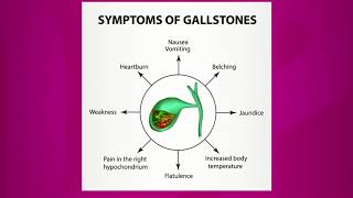 Symptoms of Gallstones [upl. by Hterag]