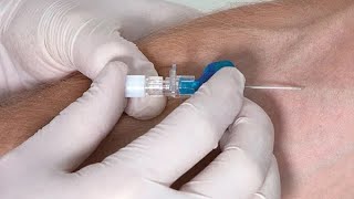 Intravenous Cannulation Insertion [upl. by Florin970]