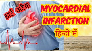 Myocardial infarction in hindi Part 2 [upl. by Igig743]