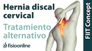 Hernia discal cervical Visión desde la medicina natural oriental [upl. by Mickey375]