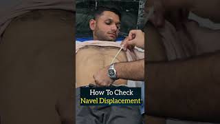 How To Check Navel Displacement naveldisplacement shortsfeed ytshortsindia ytshorts ytviral [upl. by Chiquita]