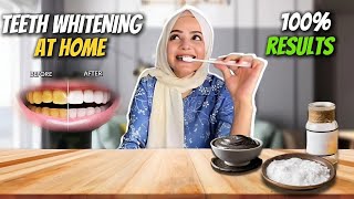 Teeth Whitening At Home  Guaranteed Results  No More Yellow Teeth  Dietitian Aqsa [upl. by Milone]