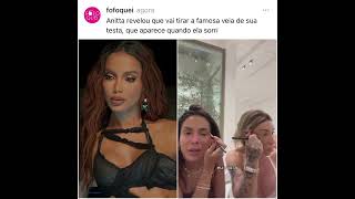 Anitta revela para Maya Massafera que pretende tira uma de sua testa e raspar os ossos da cabeça [upl. by Ettenotna]