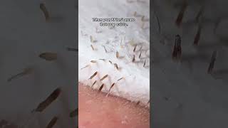 I knew that peeling would be good 🫠 explorepage satisfying skincaretip [upl. by Lewie]