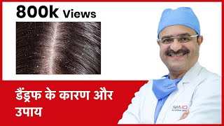 How To Get Rid Of Dandruff  डैंड्रफ के कारण और उपाय  HairMD Pune  In HINDI [upl. by Heida]