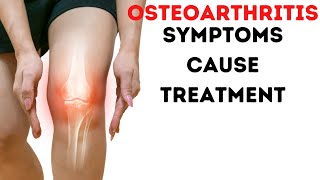 Osteoarthritis in Hindi  arthritis symptoms treatment cure [upl. by Hpejsoj46]