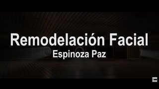 Remodelación Facial Letra  Espinoza Paz [upl. by Fayth507]