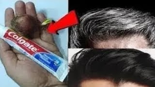 Treatment of graying hair permanently and forever without Dye  eliminate premature gray hair  ge [upl. by Rehpotisrhc773]