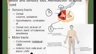 ipsilateral contralateral [upl. by Nate836]